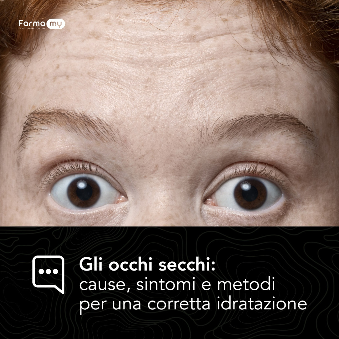 Gli Occhi Secchi: Cause, Sintomi e Metodi per una Corretta Idratazione